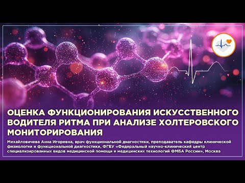 Видео: Оценка функционирования искусственного водителя ритма при анализе холтеровского мониторирования