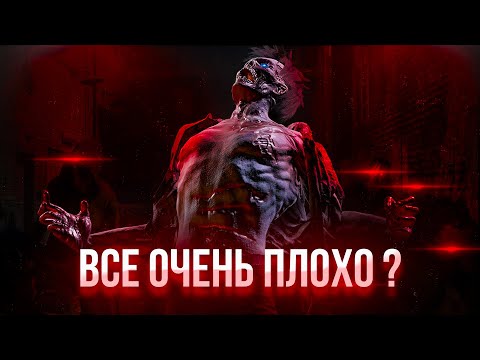 Видео: 🔥 ОБЗОР STATE OF DECAY 2 🔥 СТЕЙТ ОФ ДИКЕЙ 2 УЖАСНАЯ ? | КАК ИГРАЕТСЯ СТЕЙТ ОФ ДИКЕЙ 2 В 2024 ГОДУ ?