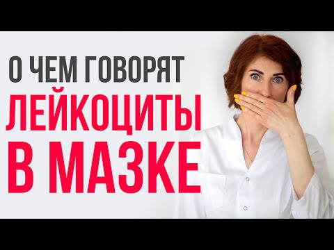 Видео: Повышенные лейкоциты в мазке у женщин: лечить или нет?
