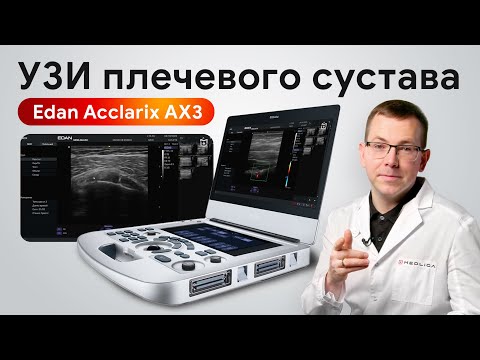 Видео: УЗИ плечевого сустава: на что способен Edan Acclarix AX3?