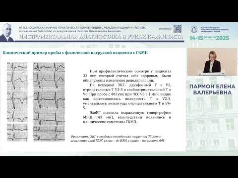 Видео: Пробы с физической нагрузкой у пациентов с кардиомиопатиями и каналопатиями