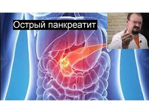Видео: Острый панкреатит.