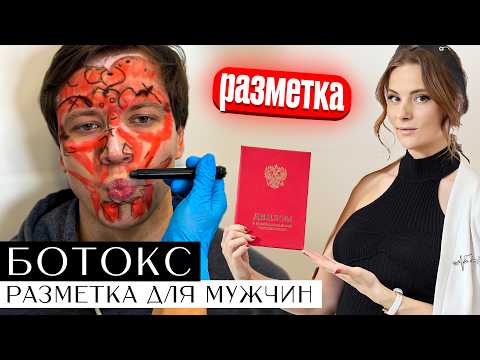 Видео: Разметка БОТОКС для мужчин