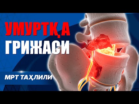 Видео: Бепул консультация - Жонли эфир (Доктор Одилбек)