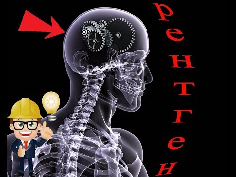 Видео: Принцип работы рентгеновского аппарата. Рентгеновское излучение