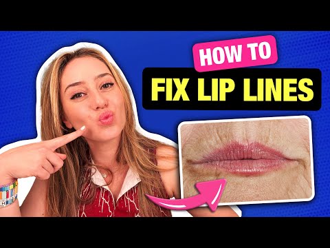 Видео: Как исправить морщины вокруг губ с помощью дерматолога! Процедуры на дому и в клинике | Доктор Ше...