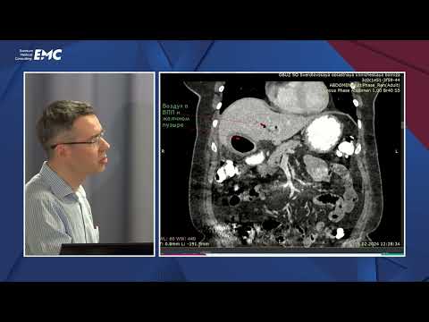 Видео: 21. Орлов