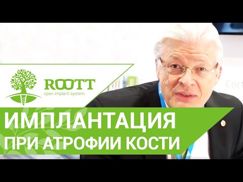 Видео: Кортикальная фиксация имплантов при атрофии костной ткани без наращивая кости