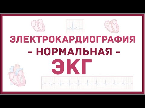Видео: ЭКГ - нормальный синусовый ритм (ЭКГ в норме)