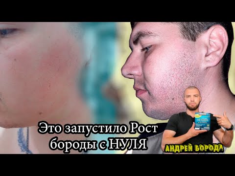 Видео: Запустил рост бороды в 22 года, результаты в конце видео / Выпуск №8 / Андрей борода