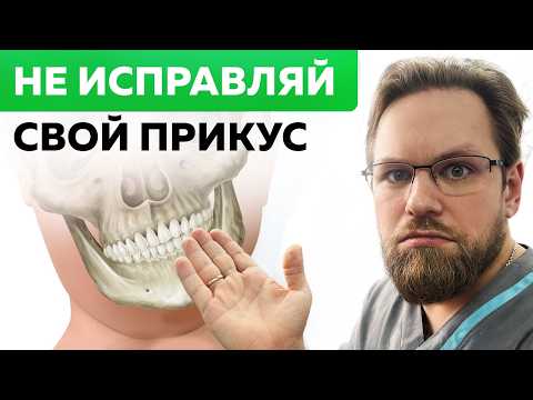 Видео: Исправили прикус? Неожиданные проблемы после исправления прикуса
