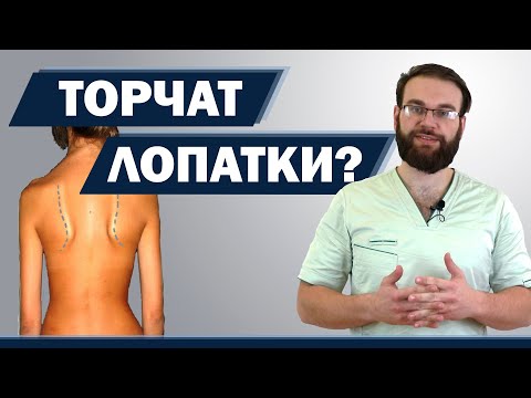 Видео: Торчат лопатки? Плечи на разном уровне? Что делать, если  ничто не помогает? | Доктор Демченко