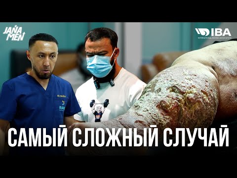 Видео: ВСЯ НОГА ГНИЕТ | ИСТОРИЯ КОТОРАЯ ТРОНУЛА ВСЕХ | АЙТЫМ ПОМОГИ МНЕ 