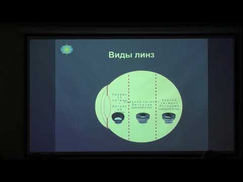 Видео: Лазерный витреолизис плавающих помутнений стекловидного тела