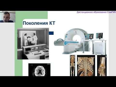 Видео: Компьютерная томография Лектор: Зельтер П.М.