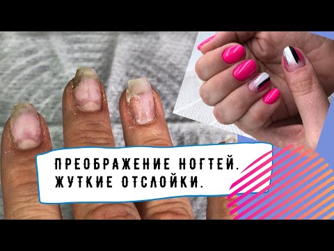 Видео: Преображение ногтей. Отслойки((((