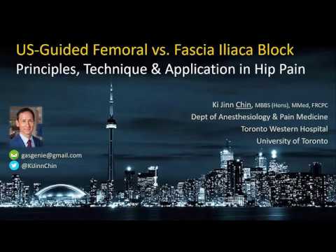 Видео: Блокады подвздошной фасции под контролем УЗИ