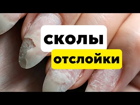 Видео: ОТСЛОЙКИ, СКОЛЫ, ТРЕЩИНЫ на покрытии/Почему бывают отслойки гель-лака и геля