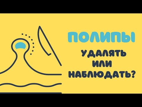 Видео: Полипы - удалять или наблюдать @DrOlenaB