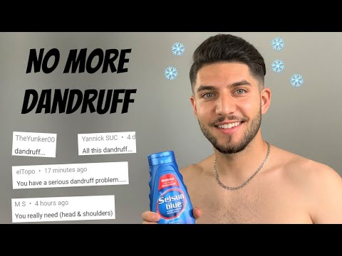 Видео: Как я избавился от перхоти/себорейного дерматита за 1 неделю