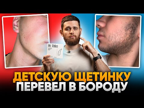 Видео: За 3 месяца зарастил бороду в 19 лет / Результаты mr.Volos для роста бороды