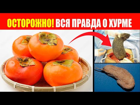 Видео: Срочно! Что делать после хурмы: советы хирурга