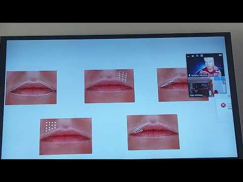 Видео: Филлеры теория(фрагмент).