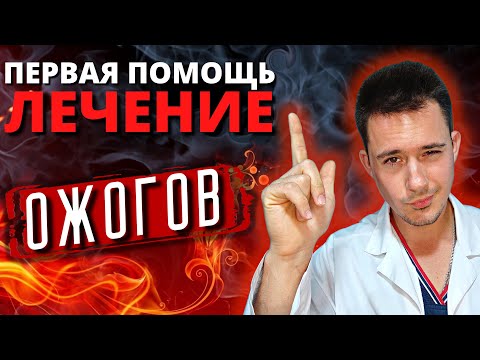 Видео: Ожоги | Первая помощь при ожогах | Лечение ожога