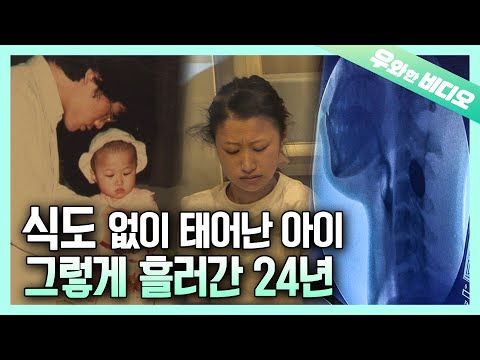 Видео: Девушка, которая не могла даже глотать воду в течение 24 лет