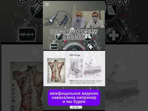 Видео: ИННЕРВАЦИЯ БРЮШНОЙ СТЕНКИ, TAP БЛОК. СЕРИЯ РЕГИОНАРНАЯ АНЕСТЕЗИЯ ЭКСПЕРТНОГО УРОВНЯ by POCUS MOSCOW