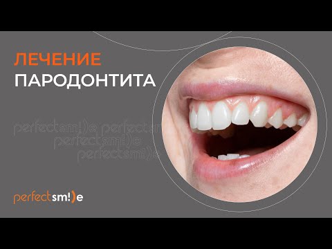 Видео: 🧐​ Лечение пародонтита
