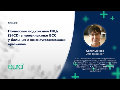 Видео: Полностью подкожный ИКД (S-ICD) в профилактике ВСС у больных с жизнеугрожающими аритмиями