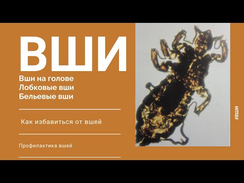 Видео: Вши. Виды вшей. Лечение. Профилактика.