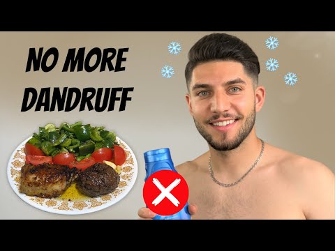 Видео: Моя диета, которая помогла мне избавиться от 90% перхоти/себорейного дерматита