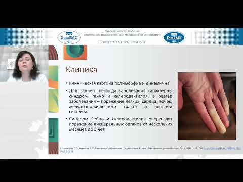 Видео: Никифорова О.Л. Синдром Шарпа