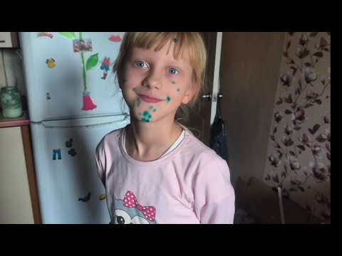 Видео: ДНІПРО🇺🇦НАЗДОЖЕНЕМО ВСЕ ПІСЛЯ ХВОРОБИ‼️