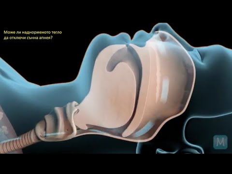 Видео: Може ли наднорменото тегло да отключи сънна апнея?