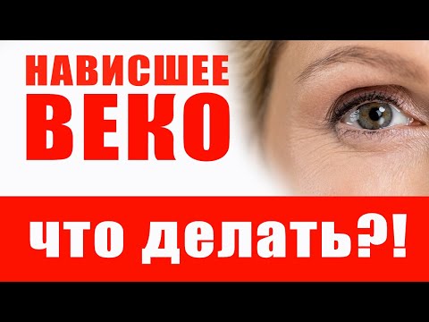 Видео: Нависшее веко... Решаемо! Главное, знать как 😉