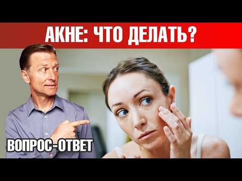 Видео: От чего отказаться, чтобы избавиться от акне?🧐