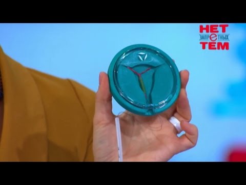 Видео: Новые методы контрацепции