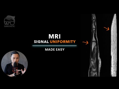 Видео: МРТ — ОДНОРОДНОСТЬ СИГНАЛА СТАЛА ПРОЩЕ