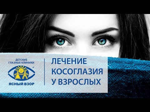 Видео: Косоглазие у взрослых. 😉 Успешное лечение косоглазия у взрослых! Ясный взор