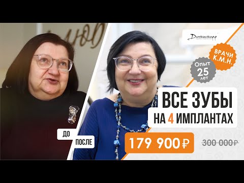 Видео: Имплантация зубов 🦷 Видео отзыв, All on 4 альтернатива, замена всех зубов до/после.