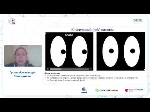 Видео: Головокружение: как клинически оценить поражение внутреннего уха? к.м.н. Гусева А.Л.
