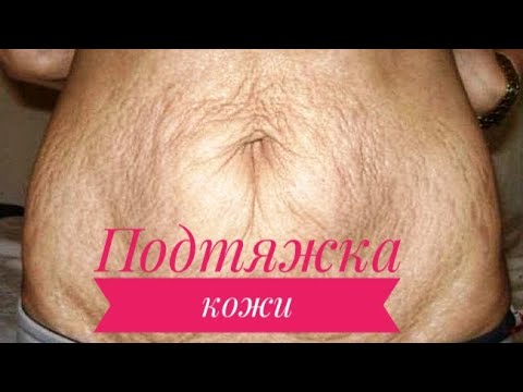 Видео: ПОДТЯЖКА КОЖИ после похудения и не только!