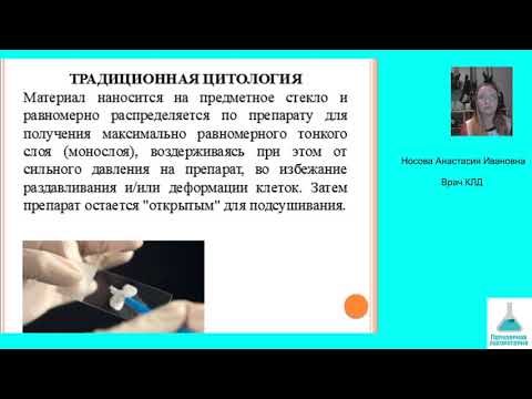 Видео: Цитологический скрининг рака шейки матки. Вебинар 8