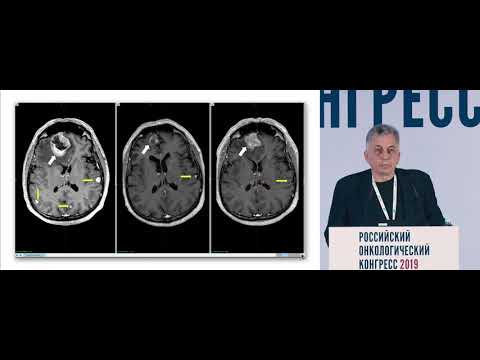 Видео: Влияние таргетной терапии на результаты радиохирургического лечения опухолей головного мозга