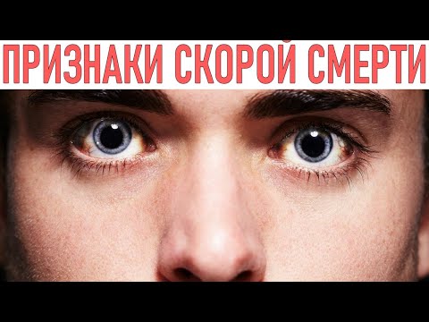 Видео: 5 признаков скорой смерти при появлении которых нужно действовать немедленно