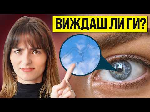 Видео: “Мушици” в Очите: Опасни Ли Са?