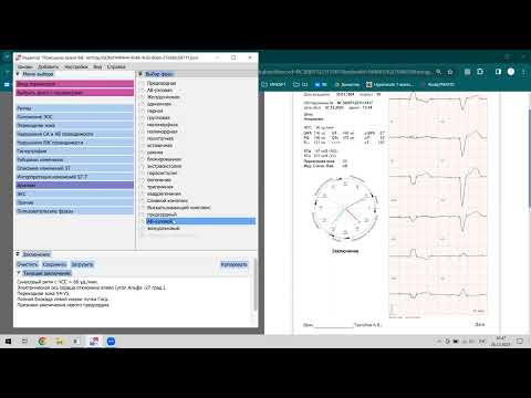 Видео: Помощник врача функциональной диагностики